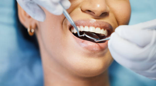Best Emergency Gum Treatment in Camp Hill, AL